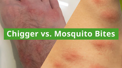 Chigger vs. Mosquito Bites: How to Identify and Repel These Pesky Pests